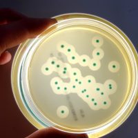Listeria monocytogenes LABROVET Jose Carlos Apolinario
